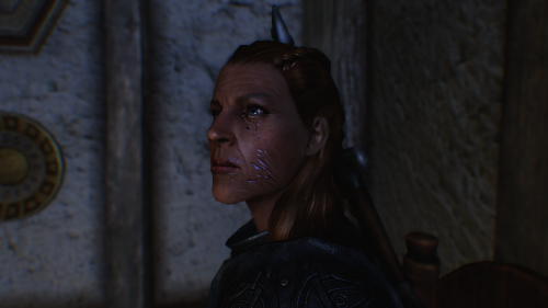 TetaSM.png
