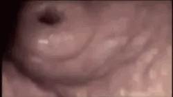 fL5RwF.gif